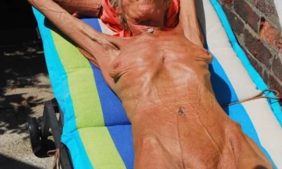 oma met anorexia ligt te zonnen